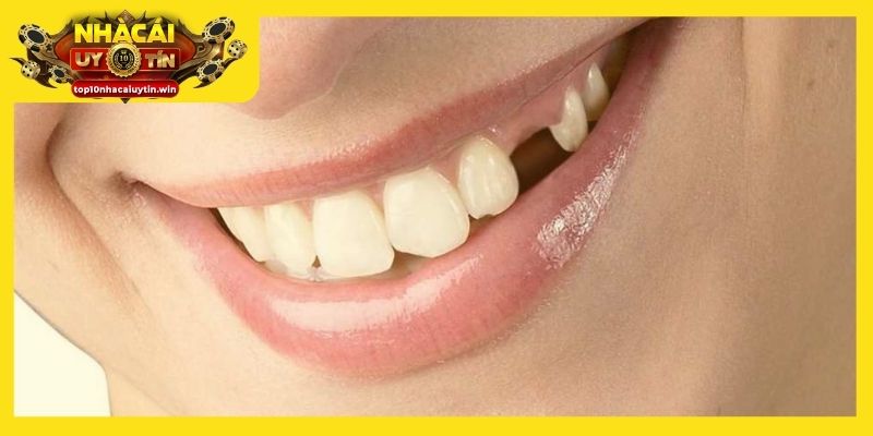 Dấu hiệu khởi đầu mới ẩn sau giấc mơ rụng răng không máu